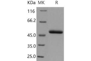 Western Blotting (WB) image for serpin Peptidase Inhibitor, Clade F (Alpha-2 Antiplasmin, Pigment Epithelium Derived Factor), Member 1 (SERPINF1) (Active) protein (His tag) (ABIN7320353)