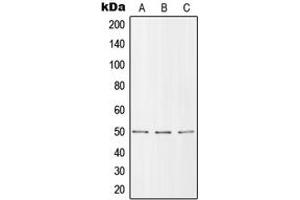Western blot analysis of ZIP7 expression in MCF7 (A), SP2/0 (B), H9C2 (C) whole cell lysates. (SLC39A7 anticorps  (Center))