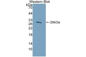 Western blot analysis of the recombinant protein. (HSPG2 anticorps  (AA 4149-4391))