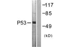 Western blot analysis of extracts from 293 cells, treated with Etoposide 25uM 60', using p53 (Ab-392) Antibody. (p53 anticorps  (AA 344-393))