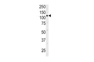 Western blot analysis of anti-ITGA6 Antibody (isoform 2 ) (ABIN389229 and ABIN2839381) in 293 cell line lysates (35 μg/lane).
