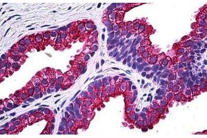 Human Prostate: Formalin-Fixed, Paraffin-Embedded (FFPE) (NPR2 anticorps  (AA 131-231))