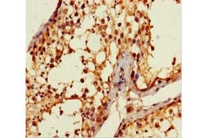 Immunohistochemistry of paraffin-embedded human testis tissue using ABIN7144155 at dilution of 1:100 (ANKDD1A anticorps  (AA 272-490))
