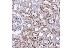 Immunohistochemical staining of human kidney with C12orf43 polyclonal antibody  shows strong cytoplasmic positivity in cells in tubules at 1:50-1:200 dilution. (C12orf43 anticorps)