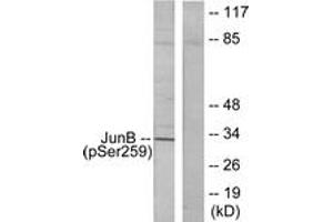 Western blot analysis of extracts from HeLa cells, using JunB (Phospho-Ser259) Antibody.