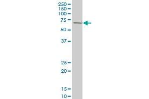 RPS6KB1 monoclonal antibody (M03), clone 2C2 Western Blot analysis of RPS6KB1 expression in A-431 .