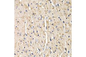 Immunohistochemistry of paraffin-embedded mouse heart using SFRP2 antibody (ABIN6131355, ABIN6147675, ABIN6147677 and ABIN6221030) at dilution of 1:200 (40x lens).