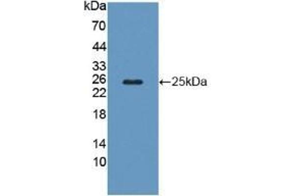 Calcyphosine Antikörper  (AA 1-189)