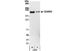 Western Blotting (WB) image for anti-CD45RO (CD45RO) antibody (ABIN7449553) (CD45RO anticorps)