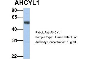 Host: Rabbit Target Name: AHCYL1 Sample Type: Human Fetal Lung Antibody Dilution: 1. (AHCYL1 anticorps  (N-Term))