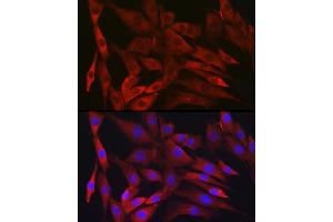 Immunofluorescence analysis of NIH/3T3 cells using IKKβ Rabbit mAb (ABIN7267873) at dilution of 1:100 (40x lens).