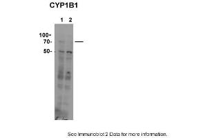Sample type: 1. (CYP11B1 anticorps  (C-Term))