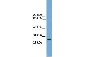 WB Suggested Anti-LRRC3 Antibody Titration:  0. (LRRC3 anticorps  (Middle Region))