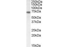 Western Blotting (WB) image for anti-Netrin 1 (NTN1) (C-Term) antibody (ABIN2464806) (Netrin 1 anticorps  (C-Term))