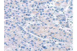 Immunohistochemistry (IHC) image for anti-Uncoupling Protein 2 (Mitochondrial, Proton Carrier) (UCP2) antibody (ABIN5958545)