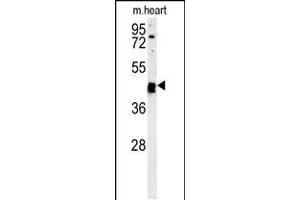 Western blot analysis in mouse heart tissue lysates (15ug/lane). (TINAGL1 anticorps  (C-Term))