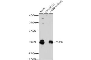 Immunoprecipitation analysis of 600 μg extracts of Mouse brain cells using 3 μg S100B antibody (ABIN3021047, ABIN3021048, ABIN3021049, ABIN1513496 and ABIN6213928).