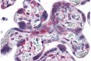 Human Placenta: Formalin-Fixed, Paraffin-Embedded (FFPE)