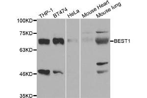 Western blot analysis of extracts of various cell lines, using BEST1 antibody (ABIN5973362) at 1/1000 dilution.