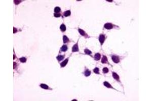 Anti-GPR27 antibody immunocytochemistry (ICC) staining of untransfected HEK293 human embryonic kidney cells.