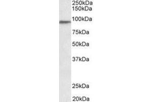 AP31936PU-N PTCHD3 antibody staining of Human Testis lysate at 0. (PTCHD3 anticorps  (Internal Region))