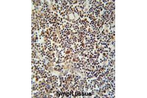 CLM1 Antibody (N-term) immunohistochemistry analysis in formalin fixed and paraffin embedded human lymph tissue followed by peroxidase conjugation of the secondary antibody and DAB staining. (IREM1 anticorps  (N-Term))
