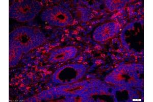 Human colon cancer 4% Paraformaldehyde-fixed and paraffin-embedded.