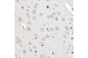 Immunohistochemistry of paraffin-embedded Rat brain using CNOT7 Rabbit pAb (ABIN6127563, ABIN6138783, ABIN6138784 and ABIN6224834) at dilution of 1:50 (40x lens). (CNOT7 anticorps  (AA 90-160))