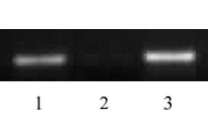 Histone H4 acetyl Lys5 antibody tested by ChIP. (Histone H4 anticorps  (acLys5))