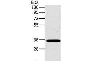 Western Blot analysis of Mouse brain tissue using OTUB1 Polyclonal Antibody at dilution of 1:800 (OTUB1 anticorps)