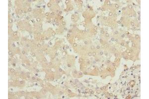 Immunohistochemistry of paraffin-embedded human liver tissue using ABIN7163408 at dilution of 1:100 (PHKB anticorps  (Regulatory Subunit beta))