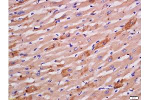 Formalin-fixed and paraffin embedded rat heart labeled with Rabbit Anti-Sarcomeric Alpha Actinin Polyclonal Antibody, Unconjugated  at 1:200 followed by conjugation to the secondary antibody and DAB staining (ACTN2 anticorps  (AA 351-450))