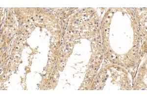 Detection of SOD1 in Bovine Testis Tissue using Monoclonal Antibody to Superoxide Dismutase 1 (SOD1)