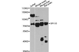 Western blot analysis of extracts of various cell lines, using SP110 antibody (ABIN6290941) at 1:1000 dilution. (SP110 anticorps)