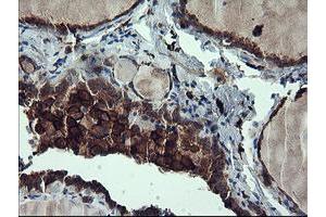 Image no. 1 for anti-CD163 (CD163) antibody (ABIN1497175)