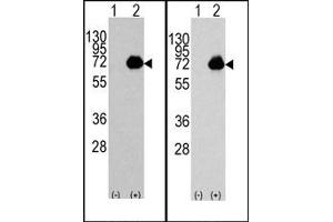 Image no. 1 for anti-Acyl-CoA Oxidase 1, Palmitoyl (ACOX1) (C-Term) antibody (ABIN357765)