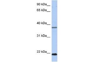 WB Suggested Anti-HDDC3 Antibody Titration: 0. (HDDC3 anticorps  (Middle Region))