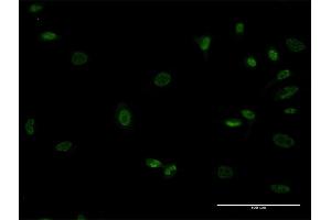 Immunofluorescence of monoclonal antibody to MEOX1 on HeLa cell. (MEOX1 anticorps  (AA 82-170))
