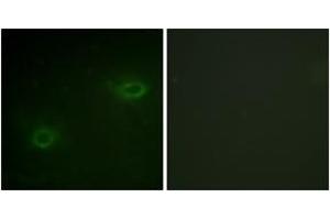 Immunofluorescence analysis of HeLa cells, using Syndecan4 (Ab-179) Antibody.