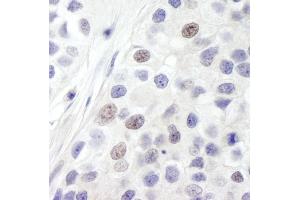 anti-Integrator Complex Subunit 8 (INTS8) (AA 200-250) antibody