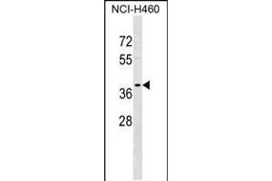 Western blot analysis in NCI-H460 cell line lysates (35ug/lane). (TPM2 anticorps  (C-Term))