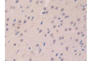 Detection of LAMa4 in Mouse Cerebrum Tissue using Polyclonal Antibody to Laminin Alpha 4 (LAMa4)