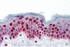 Human Skin: Formalin-Fixed, Paraffin-Embedded (FFPE)