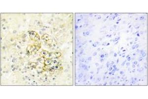 Immunohistochemistry analysis of paraffin-embedded human prostate tissue, using TMEPA Antibody. (TMEPA (AA 101-150) anticorps)