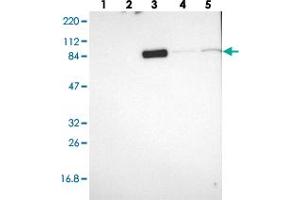 Western blot analysis of Lane 1: RT-4, Lane 2: U-251 MG, Lane 3: Human Plasma, Lane 4: Liver, Lane 5: Tonsil with MTIF2 polyclonal antibody  at 1:250-1:500 dilution.
