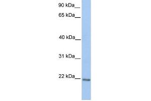 WB Suggested Anti-ZNF548 Antibody Titration:  0. (ZNF548 anticorps  (C-Term))