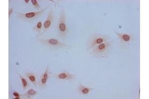 Immunocytochemistry analysis of Hela cells using ABIN7139185 at dilution of 1:100