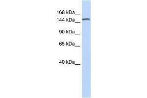 WB Suggested Anti-DGKH Antibody Titration:  0. (DGKH anticorps  (Middle Region))