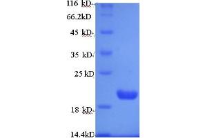 SDS-PAGE (SDS) image for Prune Exopolyphosphatase (PRUNE) (AA 1-168) protein (His tag) (ABIN4974664)