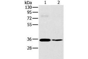 Western Blot analysis of 293T and skov3 cell using OTUB1 Polyclonal Antibody at dilution of 1:570 (OTUB1 anticorps)